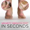 imageNYK1 Callus Remover for feet Foot Rasp Foot File and Callus Remover  Large Size Feet Scrubber Dead Skin Foot Scraper and Hard Skin Remover