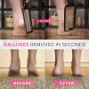 imageNYK1 Callus Remover for feet Foot Rasp Foot File and Callus Remover  Large Size Feet Scrubber Dead Skin Foot Scraper and Hard Skin Remover