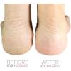 imageNYK1 Pink MEGAFILE Foot File Pedicure Rasp The Original with NYK1 Curved Smoothie Super Sharp Extra Large Micro Files MEGA File Skin Grater Remove Calloused Dry Rough Dead Skin in Seconds Add on ItemPink Megafile With Nyk1 Smoothie