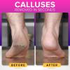 imageRUSTPROOF Foot File Callus Remover for Feet with Skin Catcher XL Size NYK1 MEGAFILE Foot Callus Remover for Wet ampamp Dry Use  HighPerformance Feet Scrubber with Textured Grip for NonSlip Control